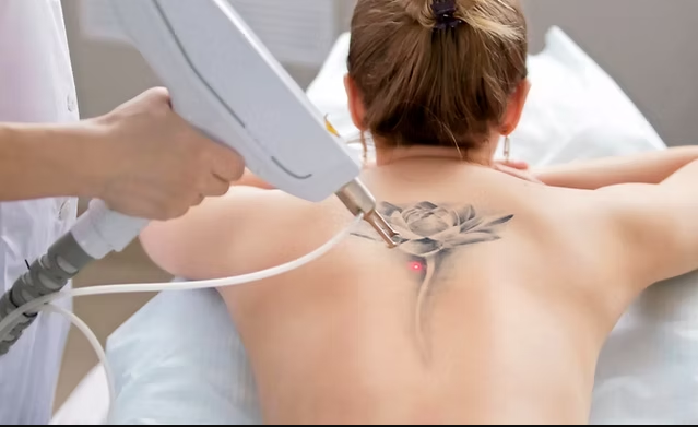 Skin Tightening Solutions