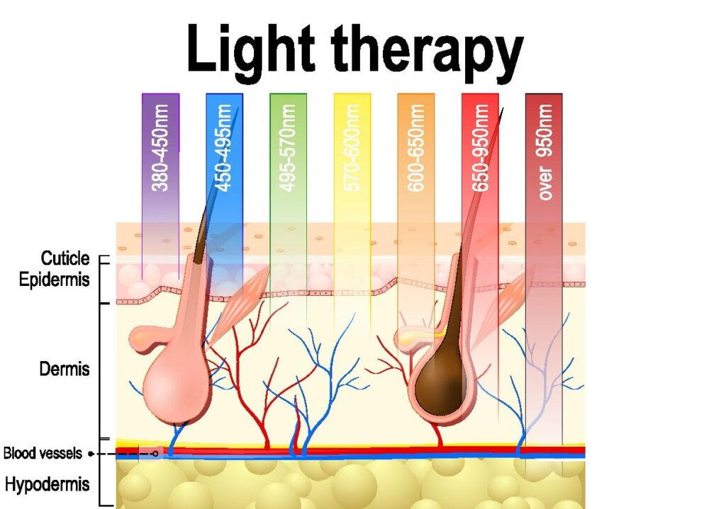 Is Red Light Therapy Effective for Hair Loss